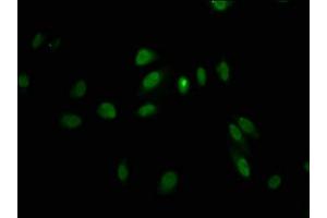 Immunofluorescence staining of Hela cells with ABIN7158383 at 1:100, counter-stained with DAPI. (LHX2 抗体  (AA 197-377))