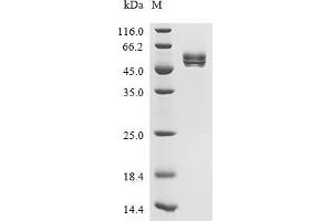 (Tris-Glycine gel) Discontinuous SDS-PAGE (reduced) with 5 % enrichment gel and 15 % separation gel.
