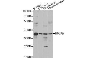 Western blot analysis of extracts of various cell lines, using RPLP0 antibody (ABIN6290910) at 1:1000 dilution. (RPLP0 抗体)