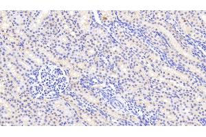 Detection of AGMAT in Human Kidney Tissue using Polyclonal Antibody to Agmatine Ureohydrolase (AGMAT) (AGMAT 抗体  (AA 53-151))