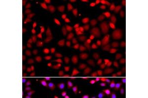 Immunofluorescence analysis of A549 cells using MTUS1 Polyclonal Antibody (MTUS1 抗体)