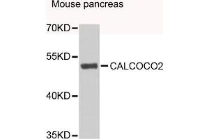 Western blot analysis of extracts of mouse pancreas, using CALCOCO2 antibody (ABIN4903108) at 1:1000 dilution. (CALCOCO2 抗体)