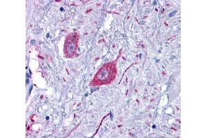 Anti-GPR6 antibody  ABIN1048845 IHC staining of human brain, neurons and glia. (GPR6 抗体  (C-Term))