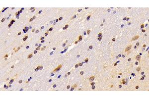 Detection of RGS6 in Rat Cerebrum Tissue using Polyclonal Antibody to Regulator Of G Protein Signaling 6 (RGS6) (RGS6 抗体  (AA 1-472))
