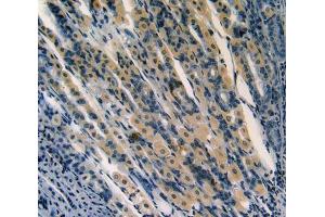 Used in DAB staining on fromalin fixed paraffin- embedded stomach tissue (aHSP 抗体  (AA 2-102))