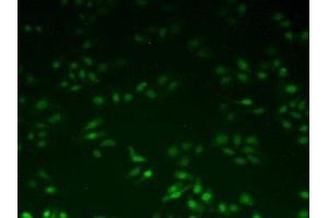 Detection of UBE2I in Human Hela Cells using Polyclonal Antibody to Ubiquitin Conjugating Enzyme E2I (UBE2I) (UBE2I 抗体  (AA 33-158))