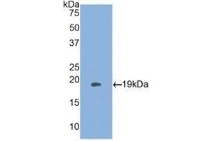 Detection of Recombinant HSPb3, Human using Polyclonal Antibody to Heat Shock Protein Beta 3 (HSPb3) (HSPB3 抗体  (AA 1-150))