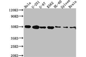 Western Blot Positive WB detected in: Hela whole cell lysate, U-251 whole cell lysate, U-87 whole cell lysate, K562 whole cell lysate, HL-60 whole cell lysate, Rat Spleen whole cell lysate, Rat Brain whole cell lysate All lanes: Dopamine Receptor D3 antibody at 1:1000 Secondary Goat polyclonal to rabbit IgG at 1/50000 dilution Predicted band size: 45, 41 kDa Observed band size: 50 kDa (Recombinant DRD3 抗体)