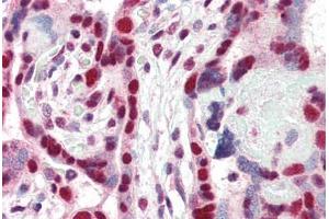 Human Placenta (formalin-fixed, paraffin-embedded) stained with CBX3 antibody ABIN337123 at 2. (CBX3 抗体  (AA 74-87))