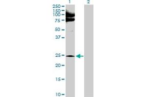 Western Blot analysis of NQO2 expression in transfected 293T cell line by NQO2 MaxPab polyclonal antibody. (NQO2 抗体  (AA 1-231))