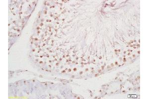 Formalin-fixed and paraffin embedded rat testis tissue labeled with Anti-PLCZ1 Polyclonal Antibody, Unconjugated at 1:200 followed by conjugation to the secondary antibody and DAB staining (PLCz1 抗体  (AA 351-450))