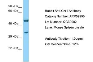 Western Blotting (WB) image for anti-Cannabinoid Receptor 1 (CNR1) (C-Term) antibody (ABIN970424) (CNR1 抗体  (C-Term))