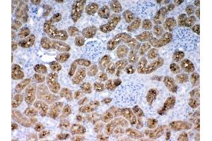 Immunohistochemistry (IHC) image for anti-Phenylalanine Hydroxylase (AA 71-208) antibody (ABIN5518942)