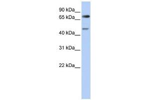 DTL antibody used at 1 ug/ml to detect target protein. (CDT2/RAMP 抗体)