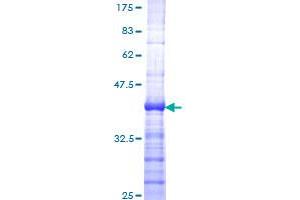 Menin Protein (AA 506-615) (GST tag)