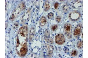 Immunohistochemical staining of paraffin-embedded Human Kidney tissue using anti-MPI mouse monoclonal antibody. (MPI 抗体)