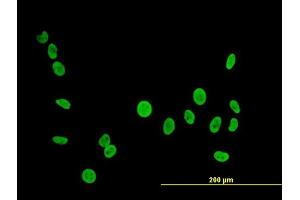 Immunofluorescence of  purified  MaxPab antibody to PTBP1 on HeLa cell. (PTBP1 抗体  (AA 1-557))