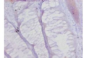 Immunohistochemistry (IHC) image for anti-Collagen, Type XVII, alpha 1 (COL17A1) (AA 1253-1497) antibody (ABIN7148231)