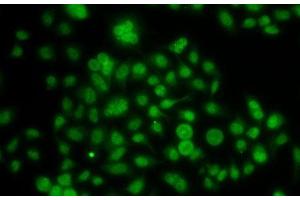 Immunofluorescence analysis of A-549 cells using ATOH7 Polyclonal Antibody (ATOH7 抗体)