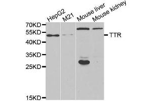 Western Blotting (WB) image for anti-Transthyretin (TTR) antibody (ABIN3017544) (TTR 抗体)