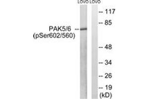 Western blot analysis of extracts from LOVO cells treated with PMA 125ng/ml 30', using PAK5/6 (Phospho-Ser602/Ser560) Antibody. (PAK5/6 (AA 566-615), (pSer602) 抗体)