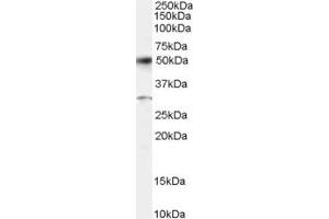 Western Blotting (WB) image for anti-Activating Transcription Factor 2 (ATF2) (AA 492-505) antibody (ABIN292594) (ATF2 抗体  (AA 492-505))