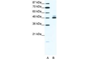 Western Blotting (WB) image for anti-Cholinergic Receptor, Nicotinic, beta 2 (Neuronal) (CHRNB2) antibody (ABIN2463733) (CHRNB2 抗体)