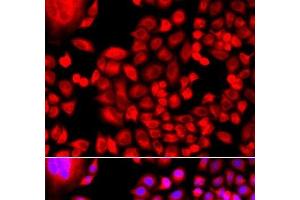 Immunofluorescence analysis of A549 cells using MTHFD1L Polyclonal Antibody (MTHFD1L 抗体)