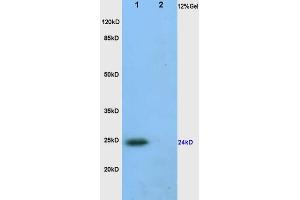 L1 human colon carcinoma, L2 rat heart lysates probed (ABIN872390) at 1:200 in 4 °C. (VEGFA 抗体  (AA 81-132))