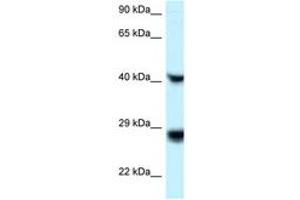 Image no. 1 for anti-Ras-Like Without CAAX 1 (RIT1) (C-Term) antibody (ABIN6747636) (RIT1 抗体  (C-Term))