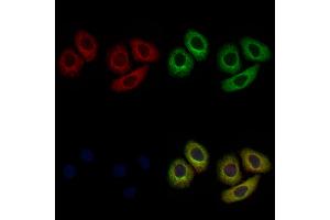 ABIN6259760 and ABIN6276996 staining Hela cells by IF/ICC.