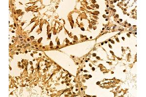 ABIN6257940 and ABIN6274488 at 1/100 staining Rat testis tissue by IHC-P. (ATF6B 抗体  (Internal Region))
