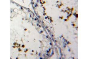 IHC-P analysis of testis tissue, with DAB staining. (NUP62 抗体  (AA 186-432))