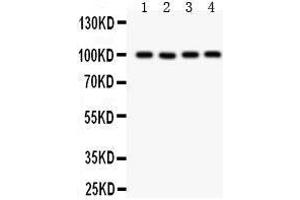 Anti- TRP 7 Picoband antibody, Western blotting All lanes: Anti TRP 7  at 0. (TRPC7 抗体  (AA 716-862))