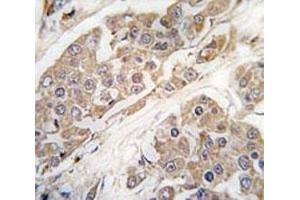 Immunohistochemistry (IHC) image for anti-CTD (Carboxy-terminal Domain, RNA Polymerase II, Polypeptide A) Small Phosphatase 2 (CTDSP2) (AA 12-42) antibody (ABIN3030574)