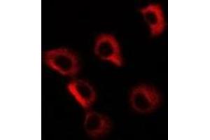 Immunofluorescent analysis of GP73 staining in MCF7 cells. (GOLM1 抗体)