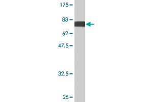 Western Blot detection against Immunogen (75. (PIK3R1 抗体  (AA 1-454))
