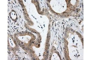 Immunohistochemical staining of paraffin-embedded Kidney tissue using anti-HDAC10 mouse monoclonal antibody. (HDAC10 抗体)