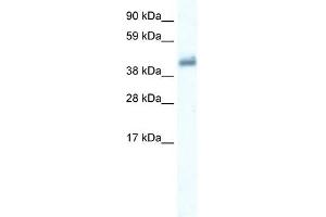 WB Suggested Anti-GABRE Antibody Titration:  0. (GABRE 抗体  (Middle Region))