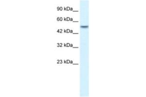 Western Blotting (WB) image for anti-Ankyrin Repeat Domain 11 (ANKRD11) antibody (ABIN2460748) (ANKRD11 抗体)