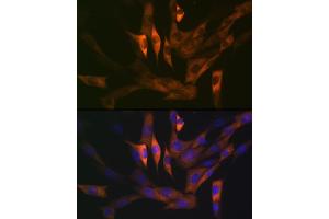Immunofluorescence (IF) image for anti-Stathmin 1 (STMN1) antibody (ABIN1678518)