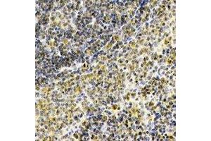 Immunohistochemical analysis of Septin 1 staining in human spleen formalin fixed paraffin embedded tissue section. (Septin 1 抗体)
