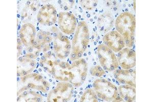 Immunohistochemistry of paraffin-embedded Rat kidney using INHBC Polyclonal Antibody at dilution of 1:100 (40x lens). (INHBC 抗体)
