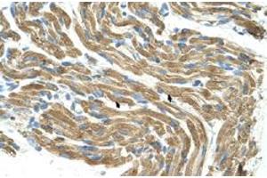 Immunohistochemical staining (Formalin-fixed paraffin-embedded sections) of human muscle with HAL polyclonal antibody  at 4-8 ug/mL working concentration. (HAL 抗体  (C-Term))