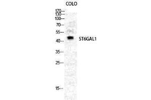 Western Blotting (WB) image for anti-ST6 beta-Galactosamide alpha-2,6-Sialyltranferase 1 (ST6GAL1) (Internal Region) antibody (ABIN3179929) (ST6GAL1 抗体  (Internal Region))