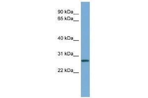 Western Blot showing CCNDBP1 antibody used at a concentration of 1-2 ug/ml to detect its target protein. (CCNDBP1 抗体  (Middle Region))