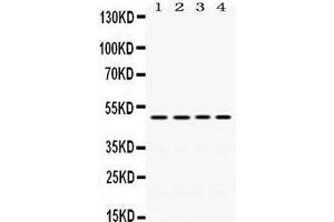 Western Blotting (WB) image for anti-Damage-Specific DNA Binding Protein 2, 48kDa (DDB2) (AA 1-115) antibody (ABIN3043488) (DDB2 抗体  (AA 1-115))