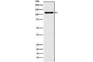 Western blot analysis of DPYD expression in HeLa cell lysate.