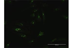 Immunofluorescence of purified MaxPab antibody to GCC1 on HeLa cell.