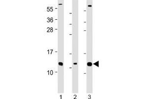 Western blot testing of human 1) Caco-2, 2) RMPI-8226 and 3) SH-SY5Y cell lysate with CKS2 antibody at 1:2000. (CKS2 抗体  (Regulatory Subunit 2))
